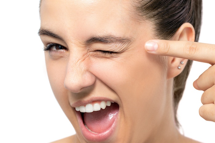 Frau mit Mimik Falten - empfohlene Augenpflege mit Microneedling